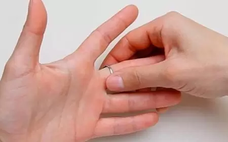 Barmağında üzük qaldı, FHN-nin xüsusi qrupu köməyə gəldi - VİDEO