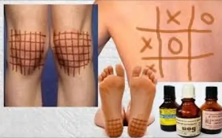 Yod kletkası hansı xəstəliklərə faydalıdır? 