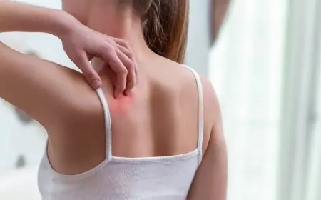 Qaşınma hansı xəstəliklərin əlaməti ola bilər?