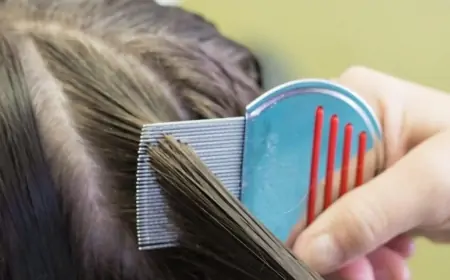 Bitləri və sirkələri dərmansız necə təmizləmək olar?