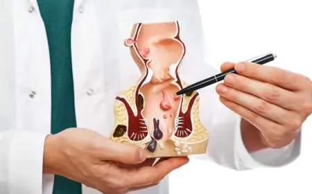 Babasillə bağlı hər şey, səbəblər və müalicəsi