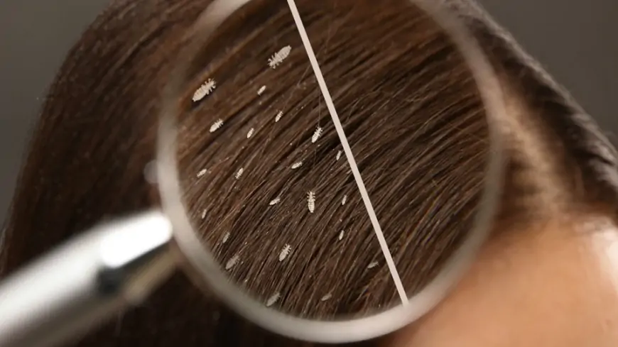 Uşağın saçına bit düşübsə, nə etməli? - Analara MƏSLƏHƏT 