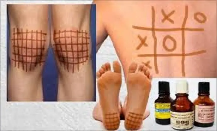 Yod kletkası hansı xəstəliklərə faydalıdır?  