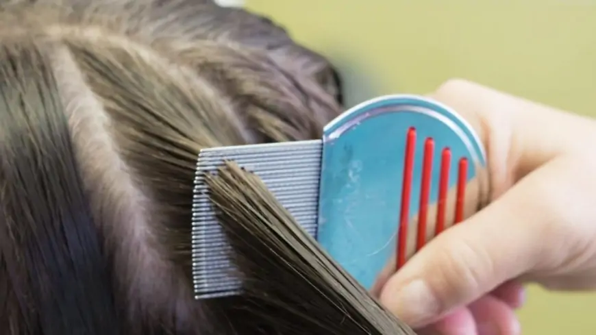 Bitləri və sirkələri dərmansız necə təmizləmək olar? - Həkim məsləhəti