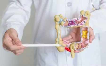 Apendisit nədir, əlamətləri və müalicəsi