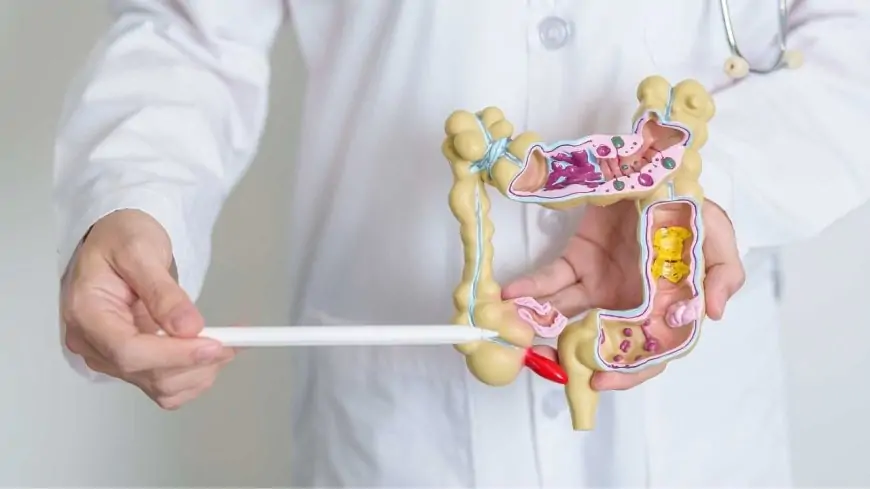 Apendisit nədir, əlamətləri və müalicəsi 