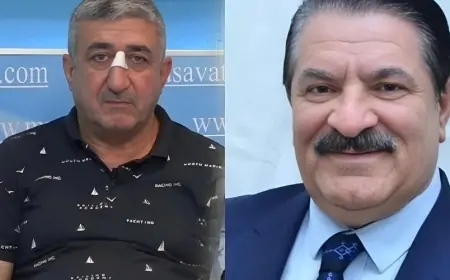 Ağadadaşın balta atdığı mühafizəçi qatarda xanıma qarşı...