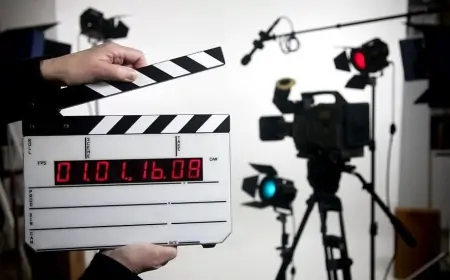 Məşhur türk aktyor tanınmaz halda