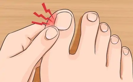 Dırnaq ətə batırsa, nə etməli?