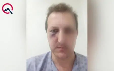Xalq artistinin oğlu Bakıda niyə döyüldüyünü AÇIQLADI 