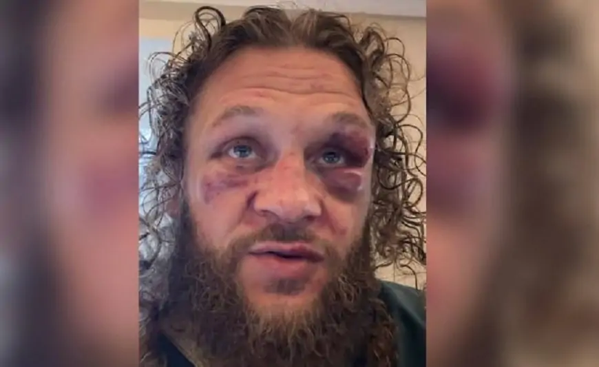 "Deyəcək söz yoxdur, yaxşıca döyüldüm" - Rafael Fiziyev + VİDEO