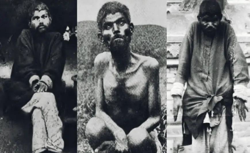 Qurdların böyütdüyü uşağın faciəli sonu - Həqiqi "Mauqli"nin həyat hekayəsi